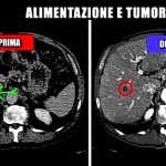 le-iene-alimentazione-tumori-gianni-05