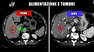 le-iene-alimentazione-tumori-gianni-05