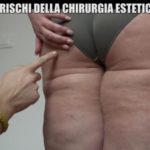 iene-danni-chirurgia-estetica-5