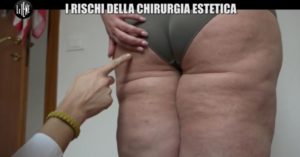 iene-danni-chirurgia-estetica-5