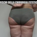 iene-danni-chirurgia-estetica-6